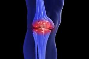 lesion de rodilla o menisco